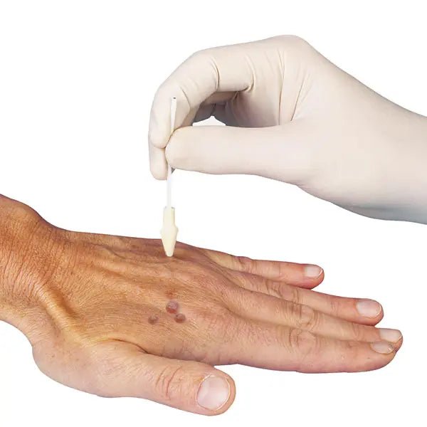 DermaFreezerErsatztipsDocMed GmbH