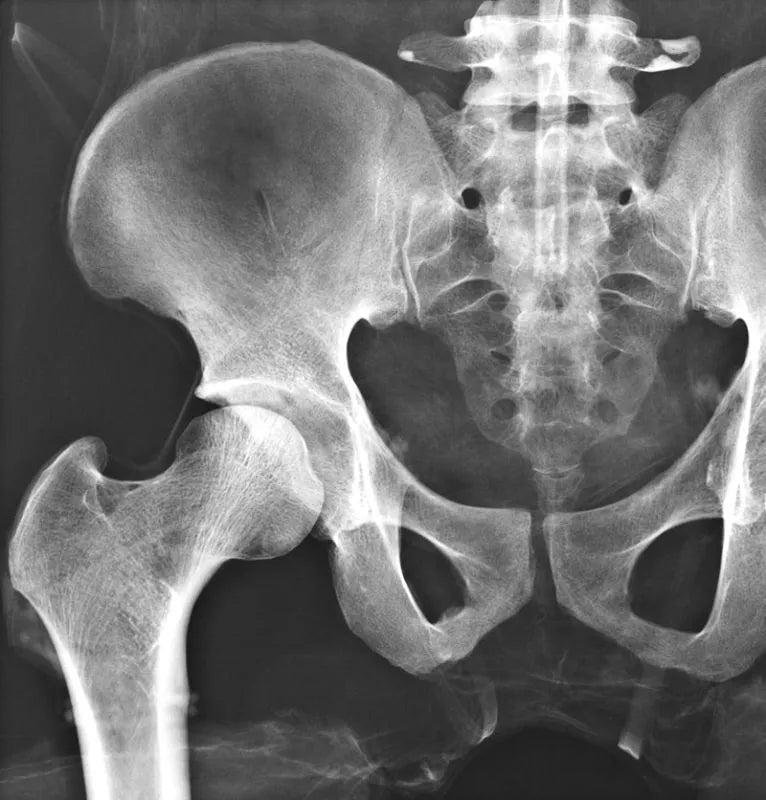 Erler-ZimmerGanzkörper RöntgenphantomDocMed GmbH