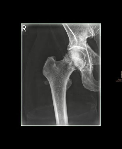 Erler-ZimmerGanzkörper RöntgenphantomDocMed GmbH