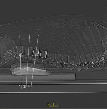 Erler-ZimmerGanzkörper RöntgenphantomDocMed GmbH