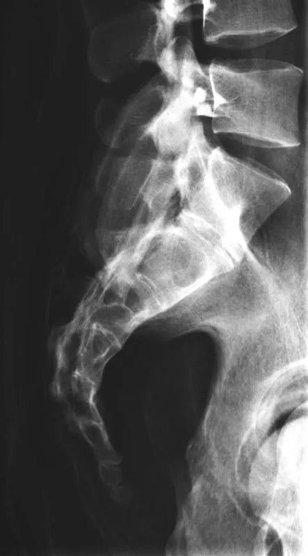 Erler-ZimmerGanzkörper RöntgenphantomDocMed GmbH