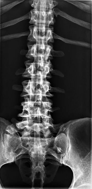 Erler-ZimmerGanzkörper RöntgenphantomDocMed GmbH