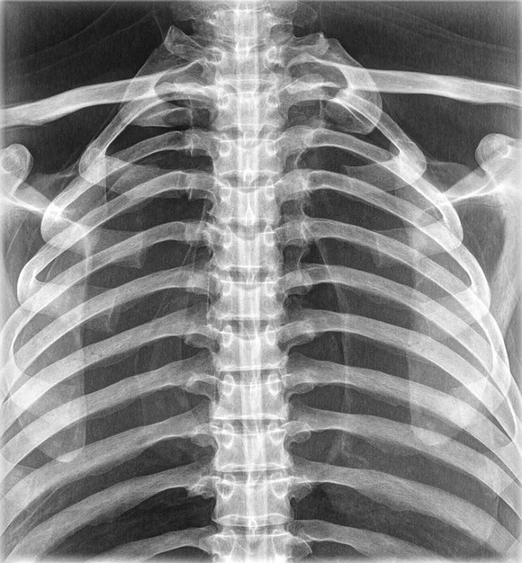Erler-ZimmerGanzkörper RöntgenphantomDocMed GmbH