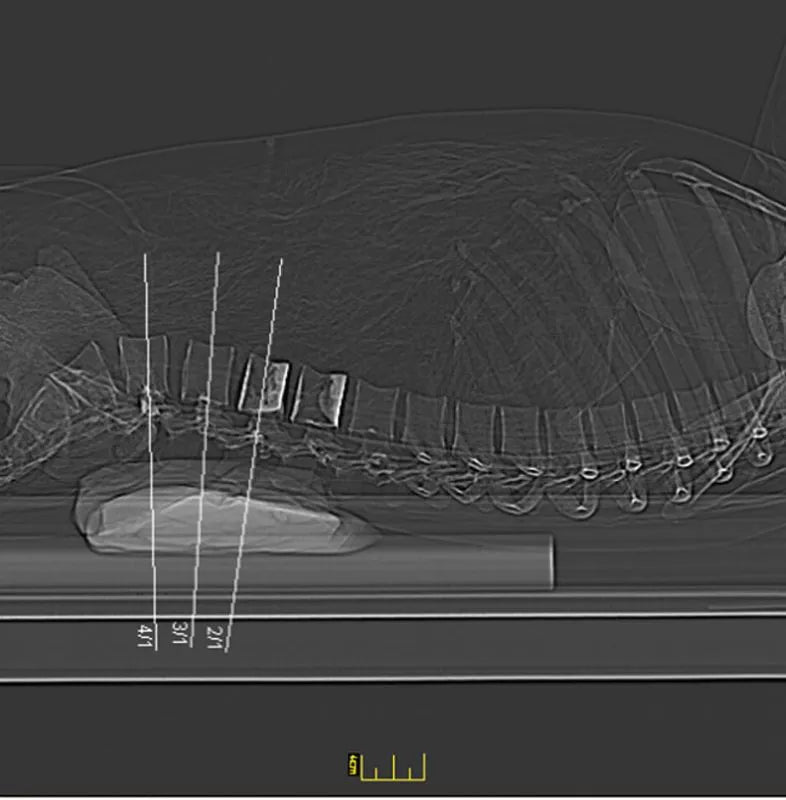 Erler - ZimmerGanzkörper RöntgenphantomDocMed GmbH