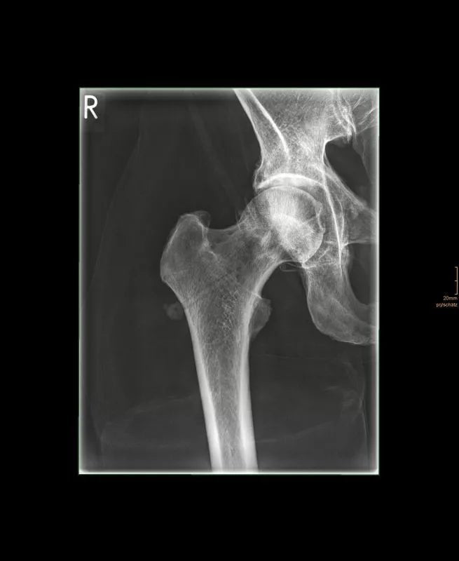 Erler - ZimmerGanzkörper RöntgenphantomDocMed GmbH