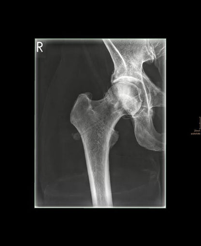 Erler - ZimmerGanzkörper RöntgenphantomDocMed GmbH