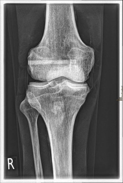 Erler - ZimmerGanzkörper RöntgenphantomDocMed GmbH
