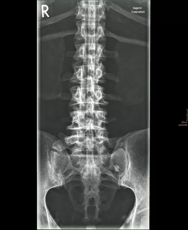 Erler - ZimmerGanzkörper RöntgenphantomDocMed GmbH