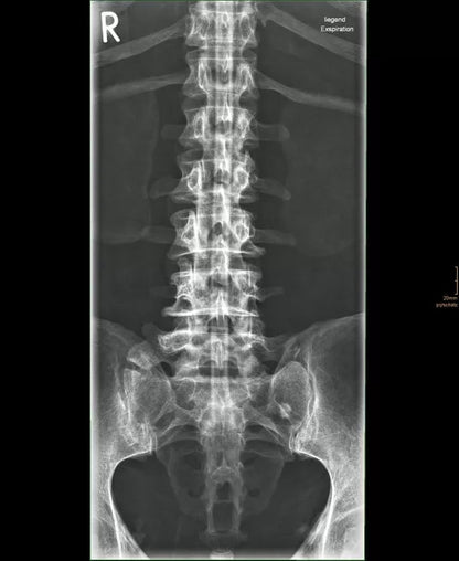 Erler - ZimmerGanzkörper RöntgenphantomDocMed GmbH