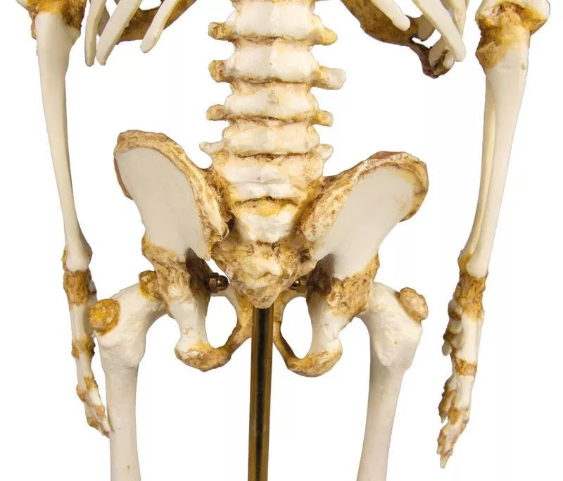 Erler - ZimmerKinderskelett, 14 bis 16 MonateDocMed GmbH