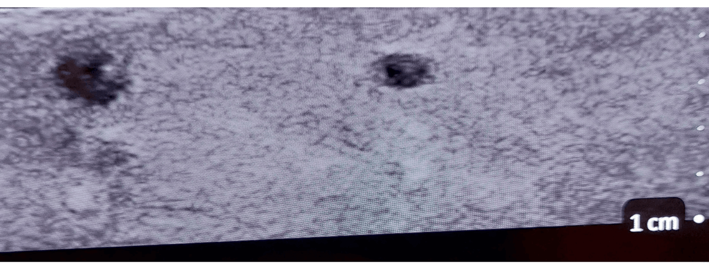 Erler-ZimmerSonoEZ Pädiatrischer Ultraschalltrainer „Gefäß“DocMed GmbH