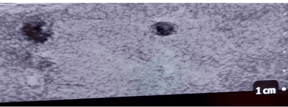 Erler-ZimmerSonoEZ Pädiatrischer Ultraschalltrainer „Gefäß“DocMed GmbH