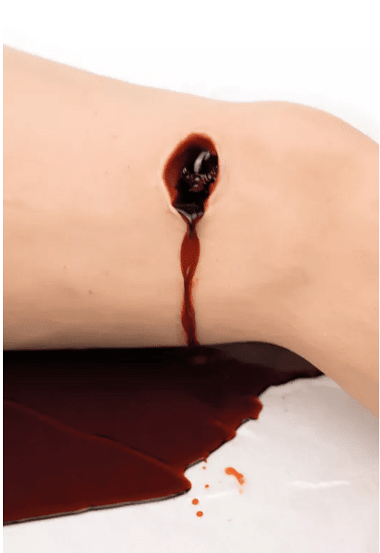 Erler-ZimmerTrauma Bein TasktrainerDocMed GmbH