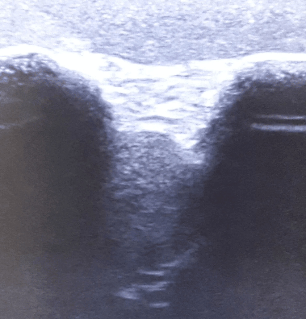 Erler-ZimmerUltraschall – Übungsmodell SchulterDocMed GmbH